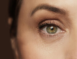 Tips to Select The Best Eye Wrinkle
